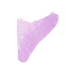 Human FFPE NAT Kidney Tissue HuN-12-0094B
