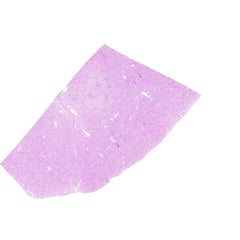 Human FFPE NAT Kidney Tissue HuN-12-0095A