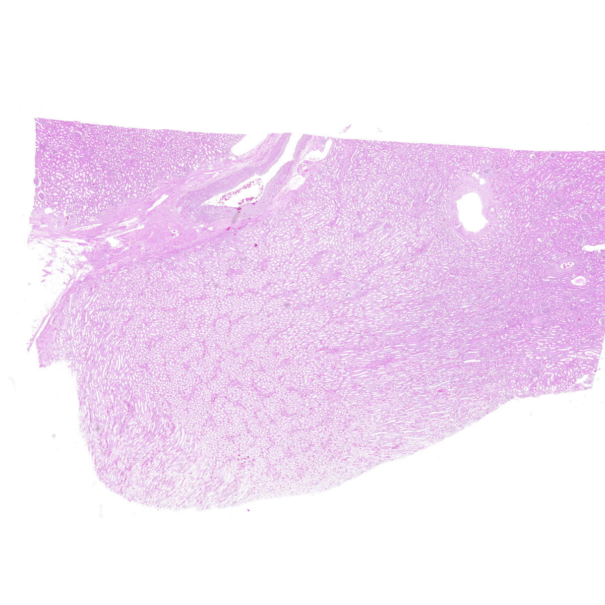 Human FFPE NAT Kidney Tissue HuN-12-0095B