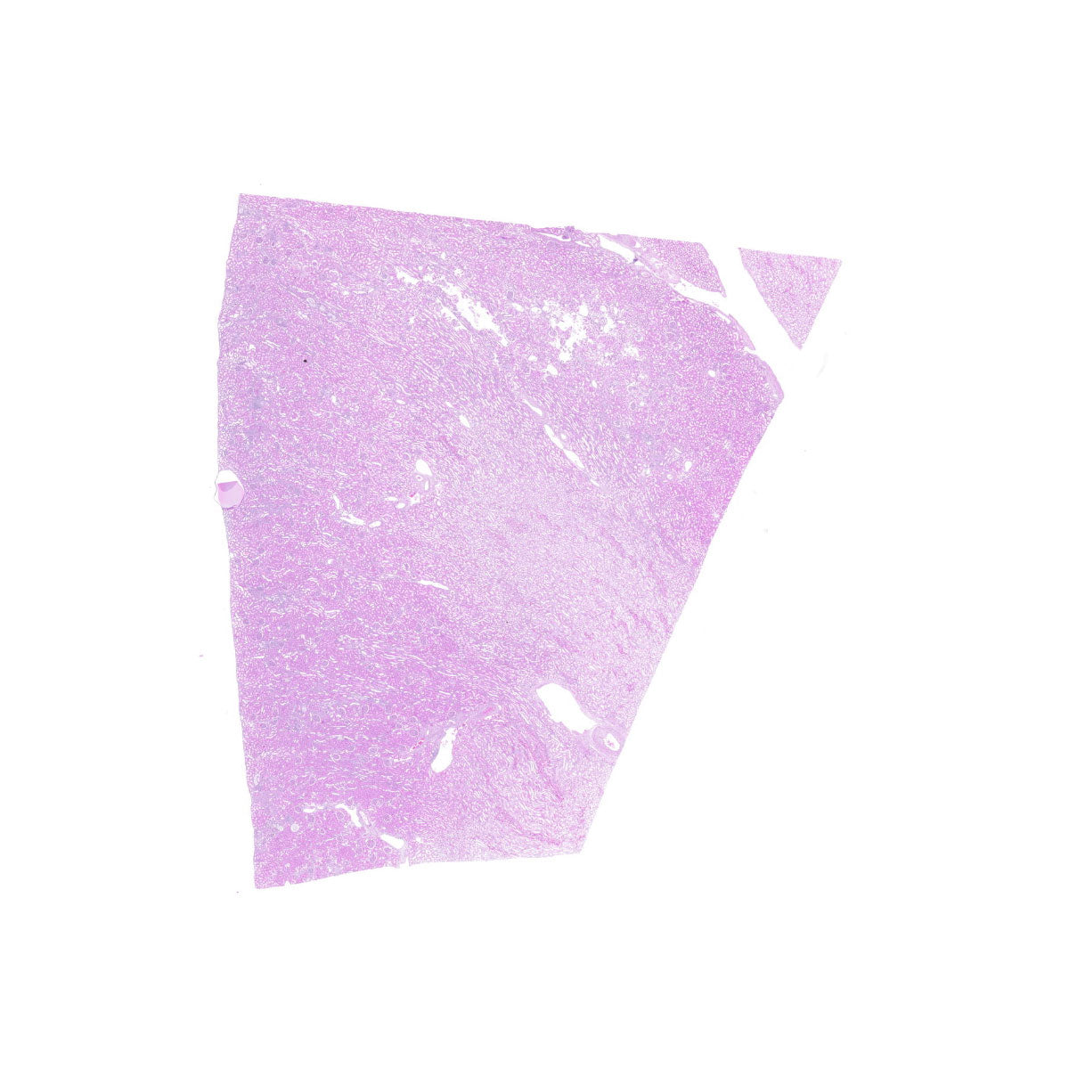 Human FFPE NAT Kidney Tissue HuN-12-0096A