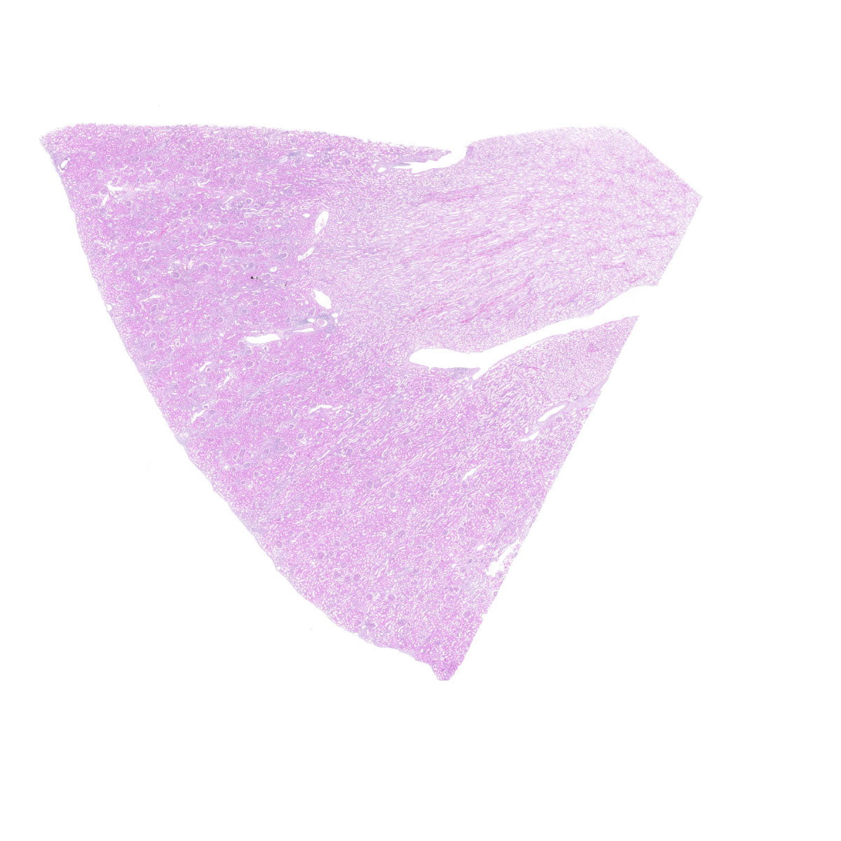 Human FFPE NAT Kidney Tissue HuN-12-0096B