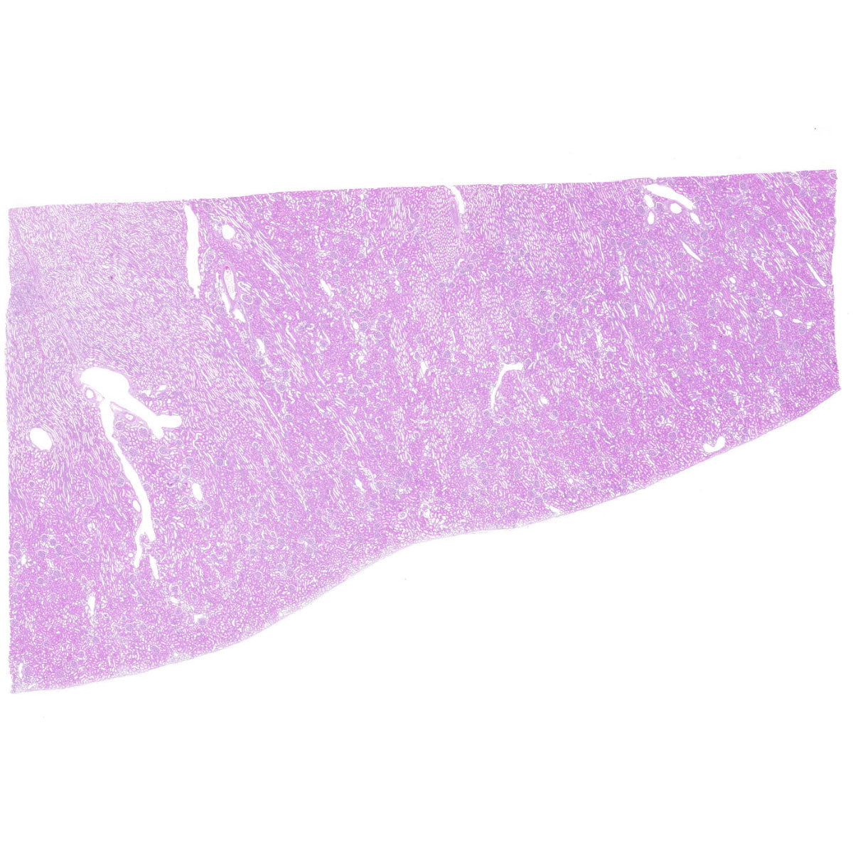 Human FFPE NAT Kidney Tissue HuN-12-0097A