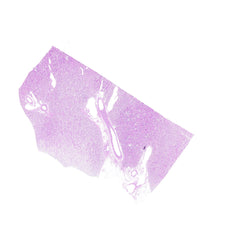 Human FFPE NAT Kidney Tissue HuN-12-0097B