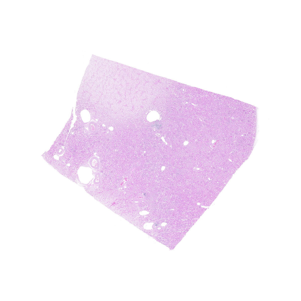 Human FFPE NAT Kidney Tissue HuN-12-0098A