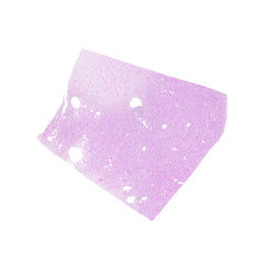 Human FFPE NAT Kidney Tissue HuN-12-0098A