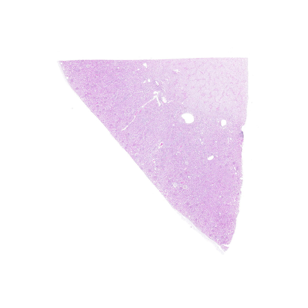 Human FFPE NAT Kidney Tissue HuN-12-0098B