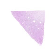Human FFPE NAT Kidney Tissue HuN-12-0098B