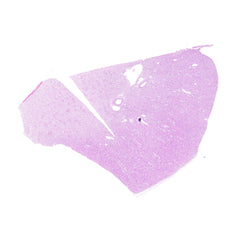 Human FFPE NAT Kidney Tissue HuN-12-0099