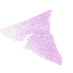 Human FFPE NAT Kidney Tissue HuN-12-0100