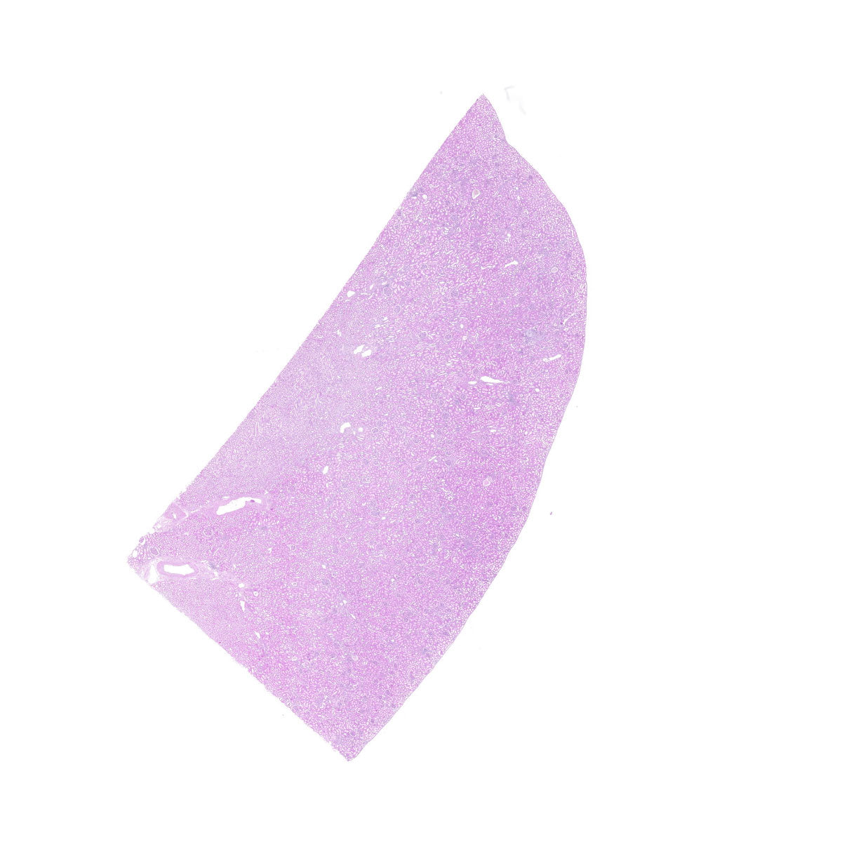 Human FFPE NAT Kidney Tissue HuN-12-0101