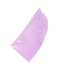 Human FFPE NAT Kidney Tissue HuN-12-0101