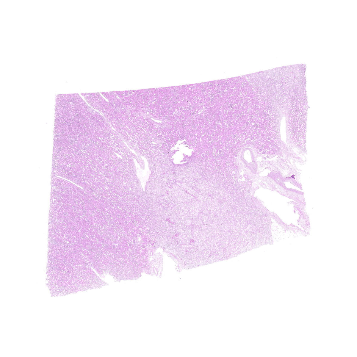 Human FFPE NAT Kidney Tissue HuN-12-0102