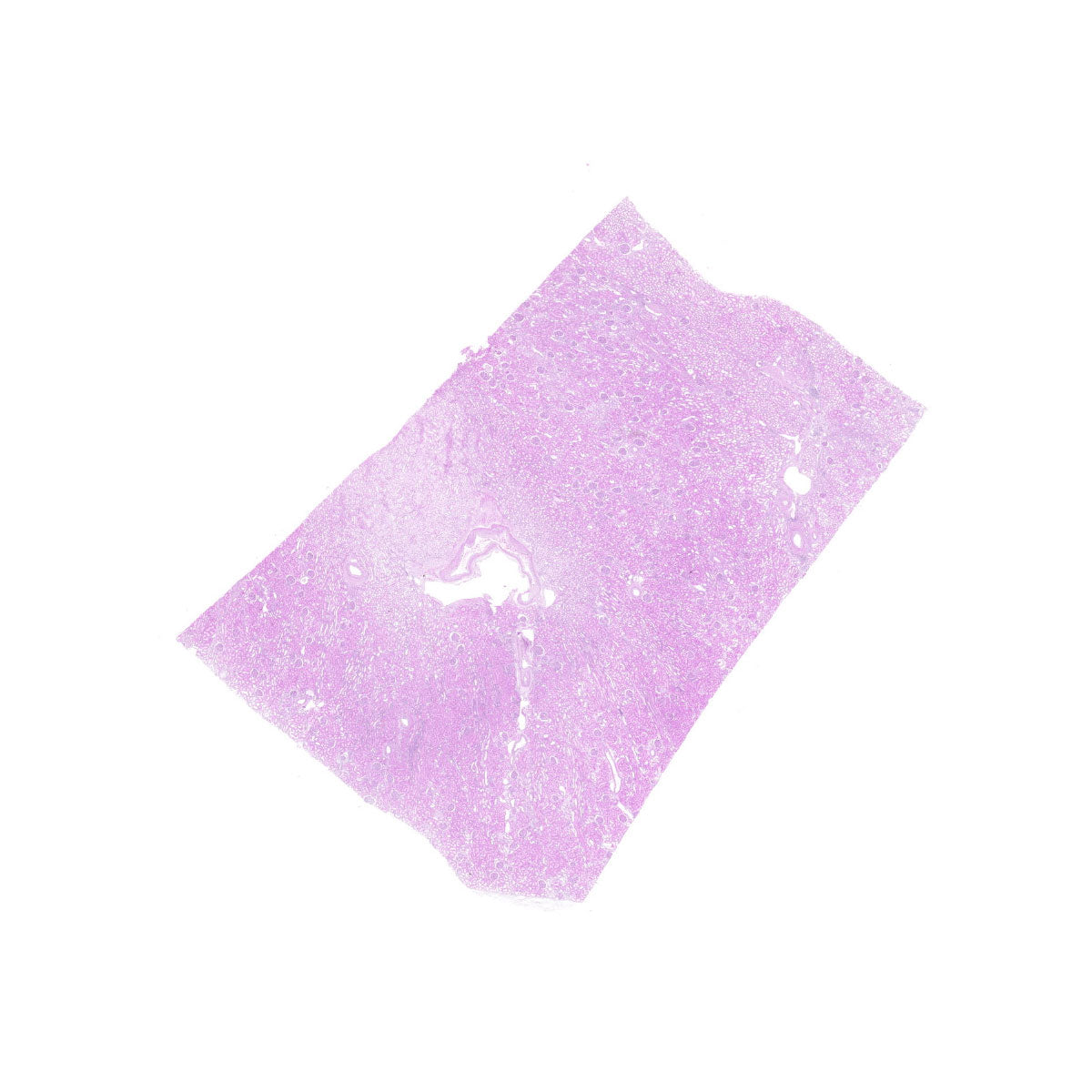 Human FFPE NAT Kidney Tissue HuN-12-0103A