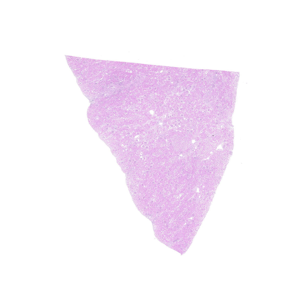 Human FFPE NAT Kidney Tissue HuN-12-0103B