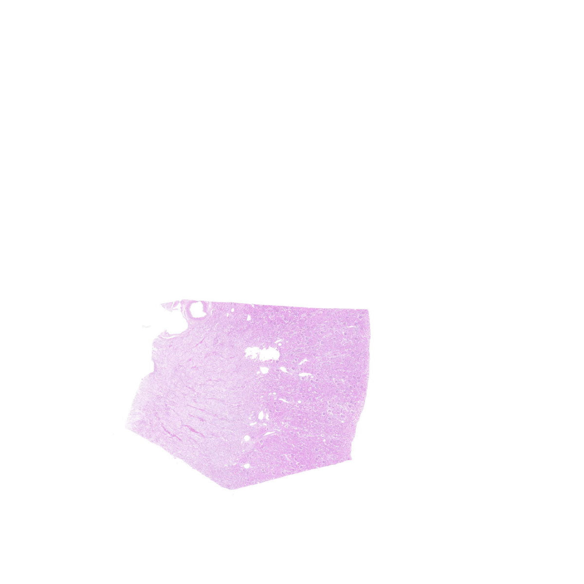 Human FFPE NAT Kidney Tissue HuN-12-0104A