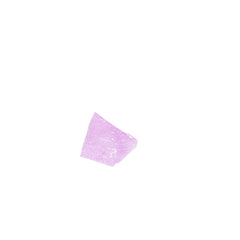 Human FFPE NAT Kidney Tissue HuN-12-0104B