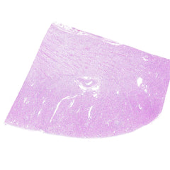 Human FFPE NAT Kidney Tissue HuN-12-0105
