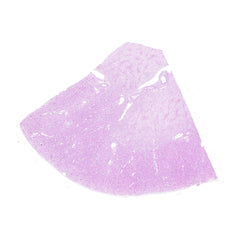 Human FFPE NAT Kidney Tissue HuN-12-0106