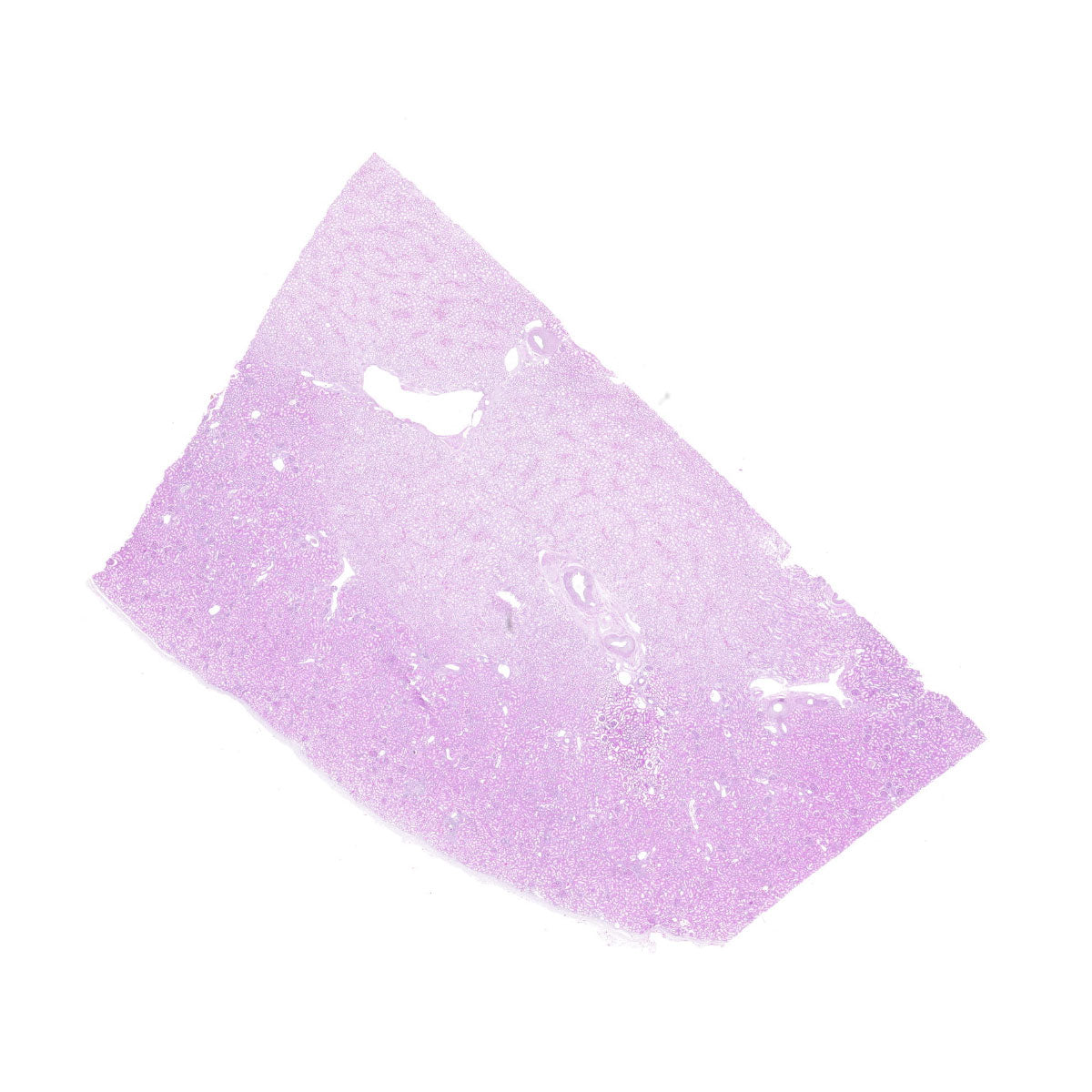 Human FFPE NAT Kidney Tissue HuN-12-0107