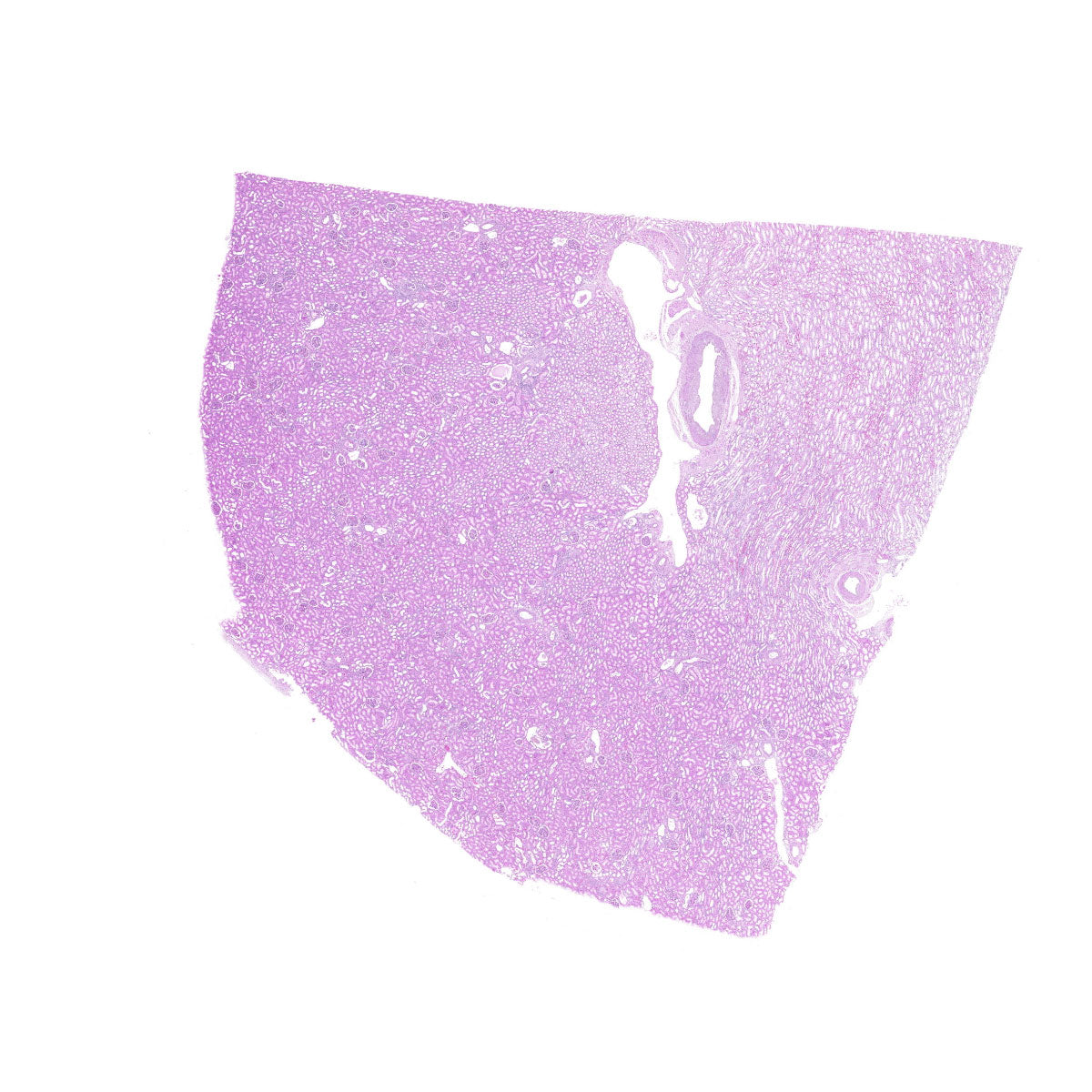 Human FFPE NAT Kidney Tissue HuN-12-0108