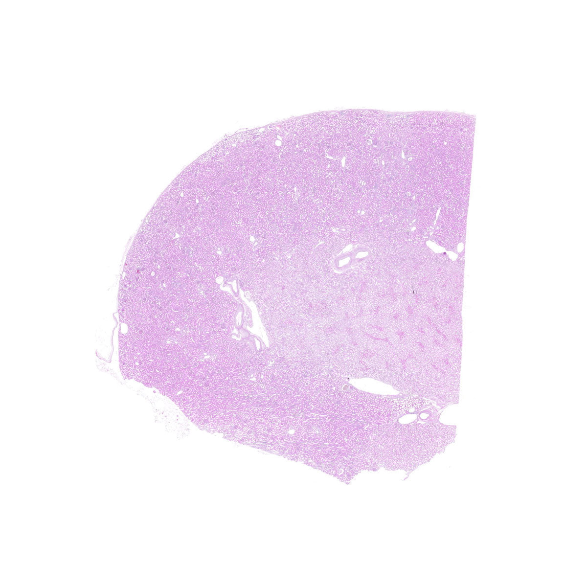 Human FFPE NAT Kidney Tissue HuN-12-0109