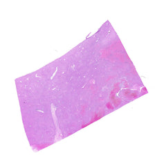 Human FFPE NAT Liver Tissue HuN-14-0072A