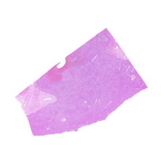 Human FFPE NAT Liver Tissue HuN-14-0072B