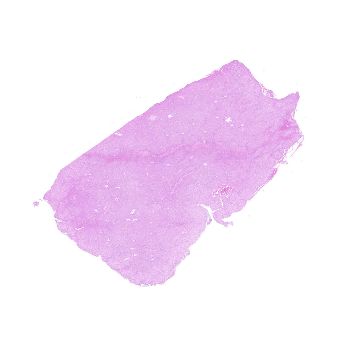 Human FFPE NAT Liver Tissue HuN-14-0073A