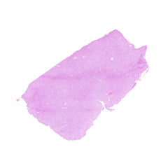 Human FFPE NAT Liver Tissue HuN-14-0073A