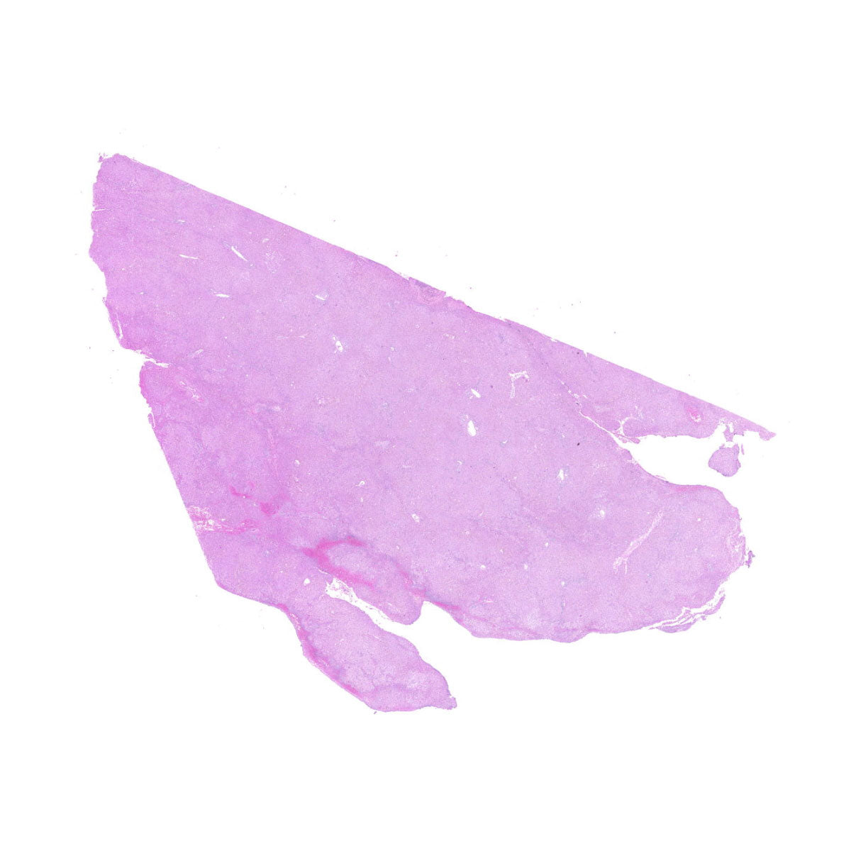 Human FFPE NAT Liver Tissue HuN-14-0073B