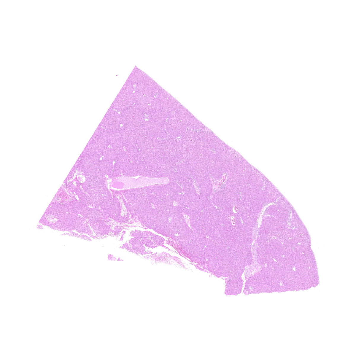 Human FFPE NAT Liver Tissue HuN-14-0074A