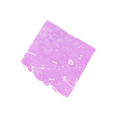 Human FFPE NAT Liver Tissue HuN-14-0074B