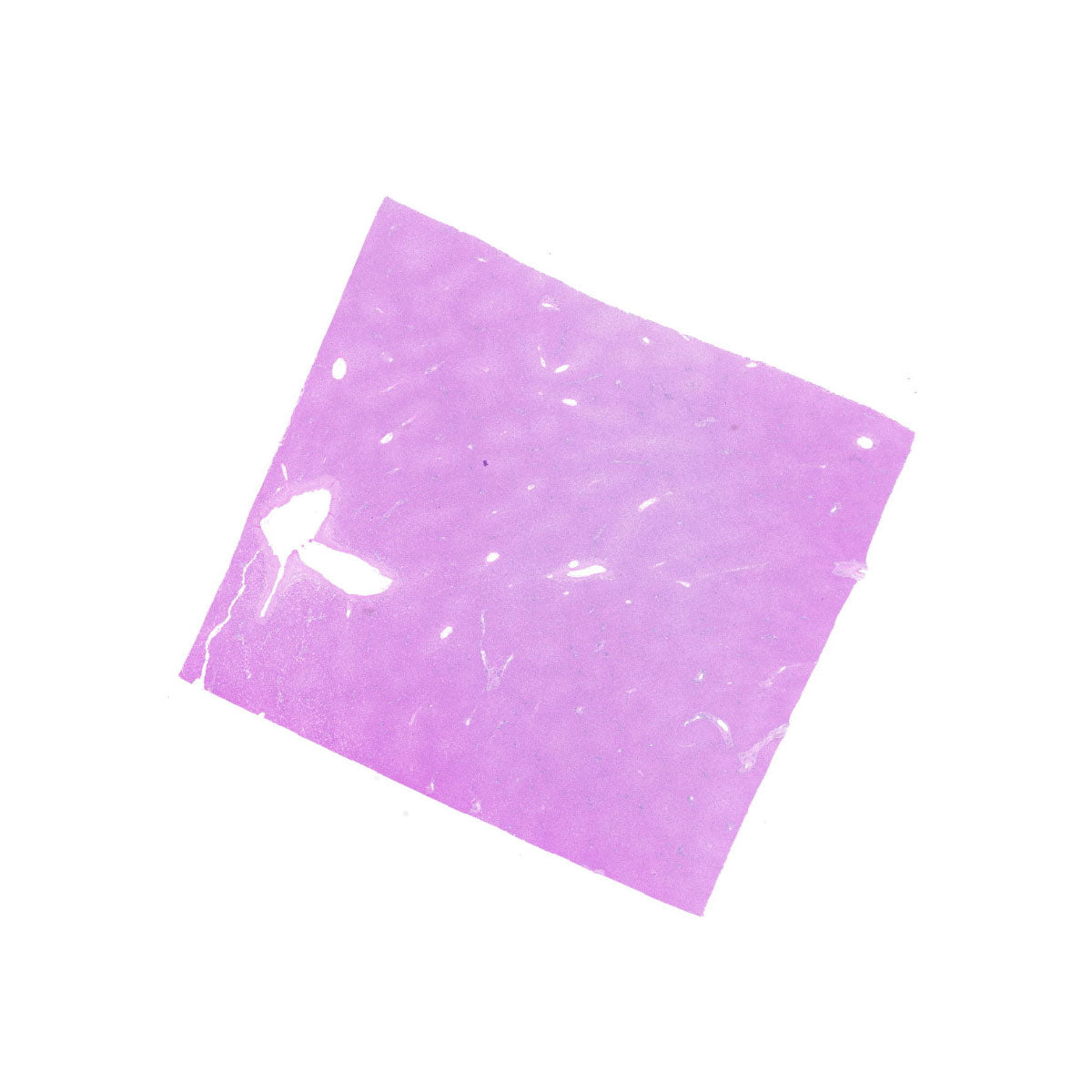 Human FFPE NAT Liver Tissue HuN-14-0076A