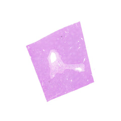 Human FFPE NAT Liver Tissue HuN-14-0076B