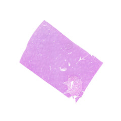 Human FFPE NAT Liver Tissue HuN-14-0077A