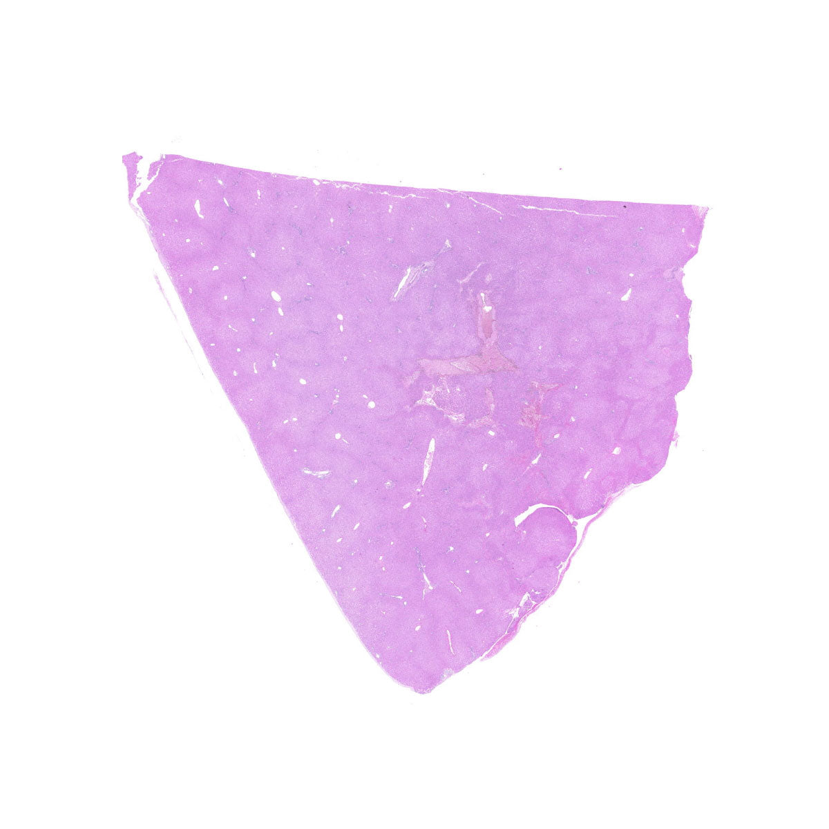 Human FFPE NAT Liver Tissue HuN-14-0077B