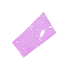 Human FFPE NAT Liver Tissue HuN-14-0078A
