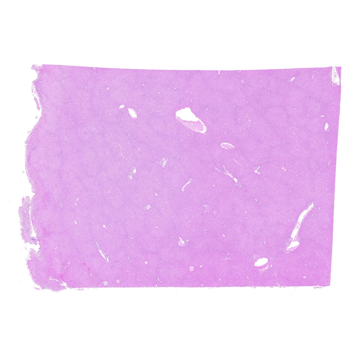 Human FFPE NAT Liver Tissue HuN-14-0079A