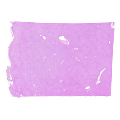 Human FFPE NAT Liver Tissue HuN-14-0079A
