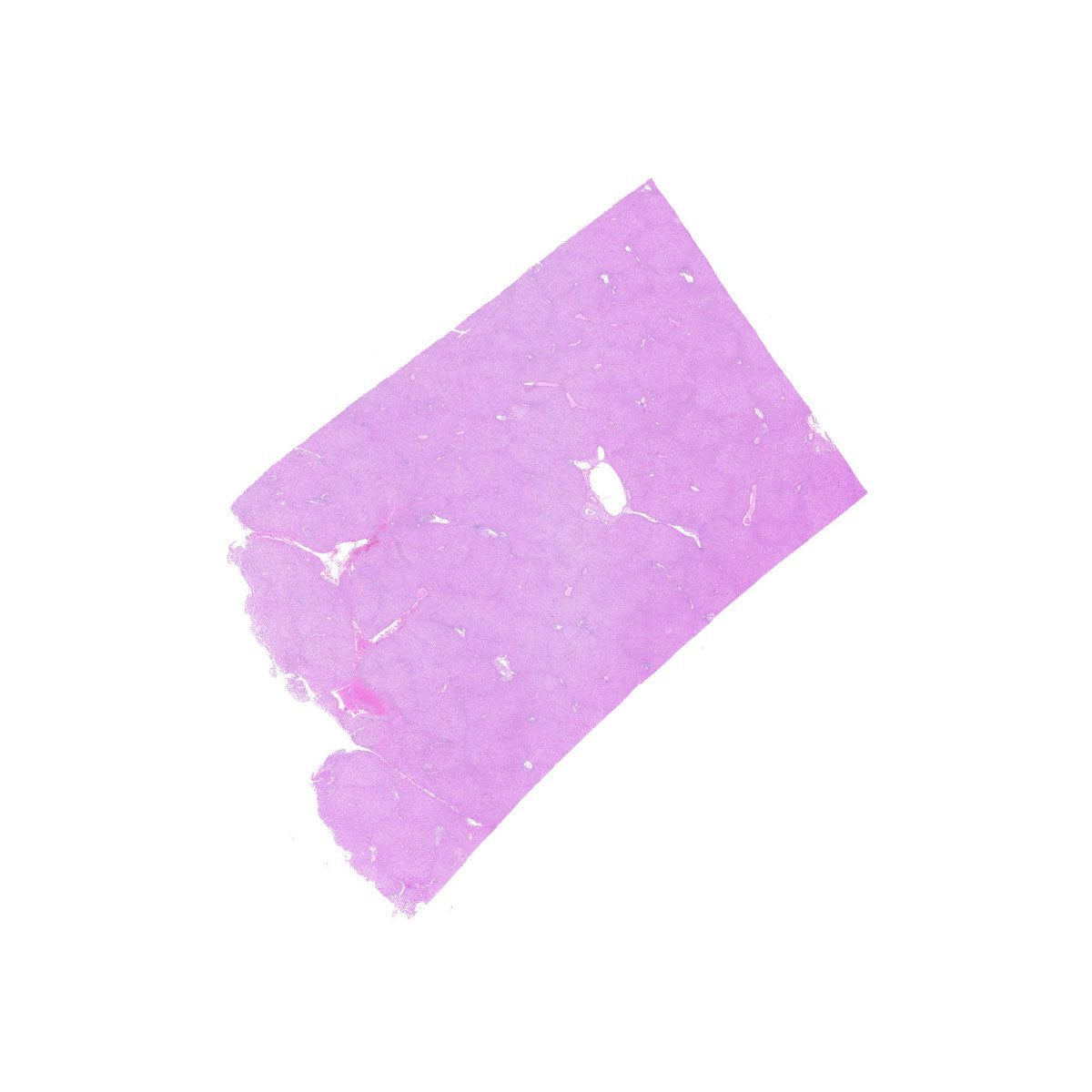 Human FFPE NAT Liver Tissue HuN-14-0079B