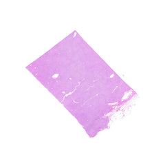 Human FFPE NAT Liver Tissue HuN-14-0080A