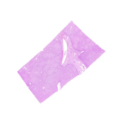 Human FFPE NAT Liver Tissue HuN-14-0083A