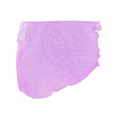 Human FFPE NAT Liver Tissue HuN-14-0084A