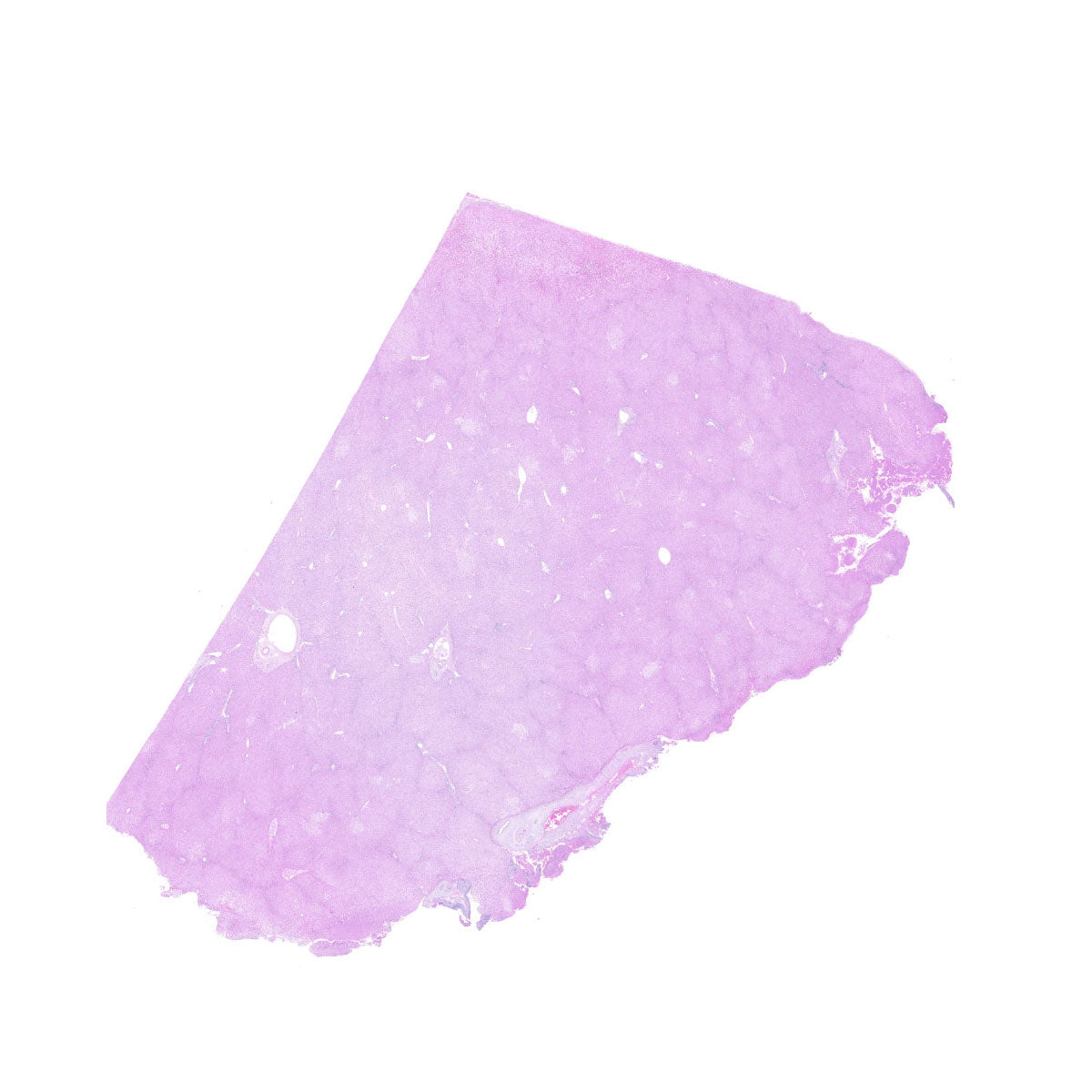 Human FFPE NAT Liver Tissue HuN-14-0085A