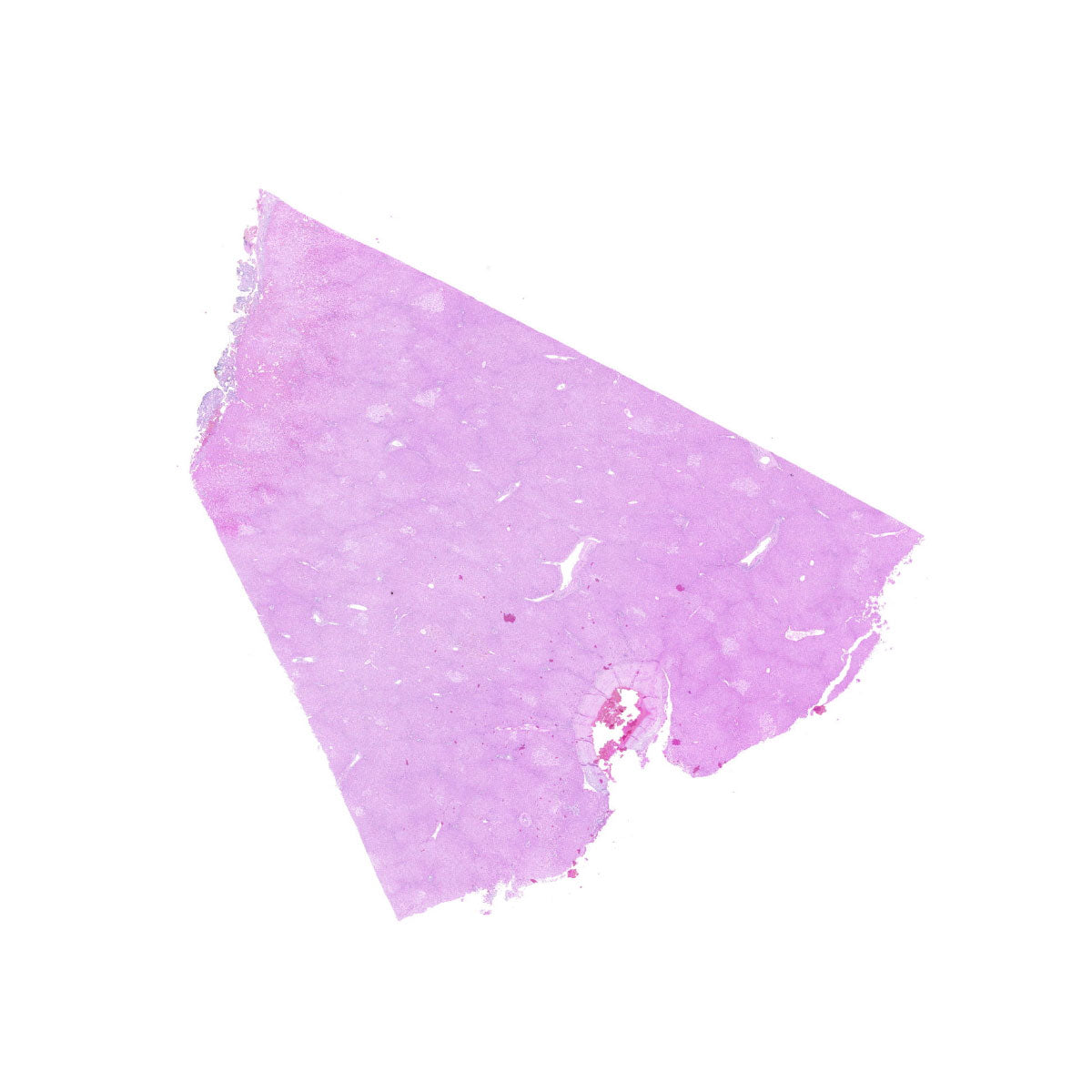 Human FFPE NAT Liver Tissue HuN-14-0085B