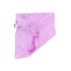 Human FFPE NAT Liver Tissue HuN-14-0086B