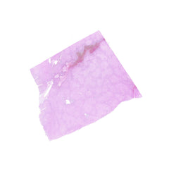Human FFPE NAT Liver Tissue HuN-14-0086C