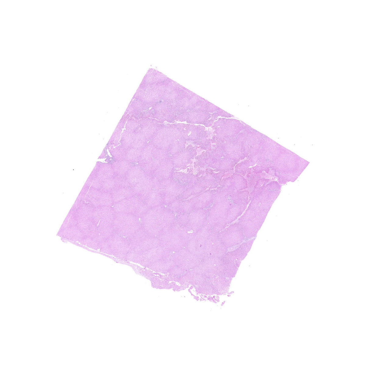 Human FFPE NAT Liver Tissue HuN-14-0086D
