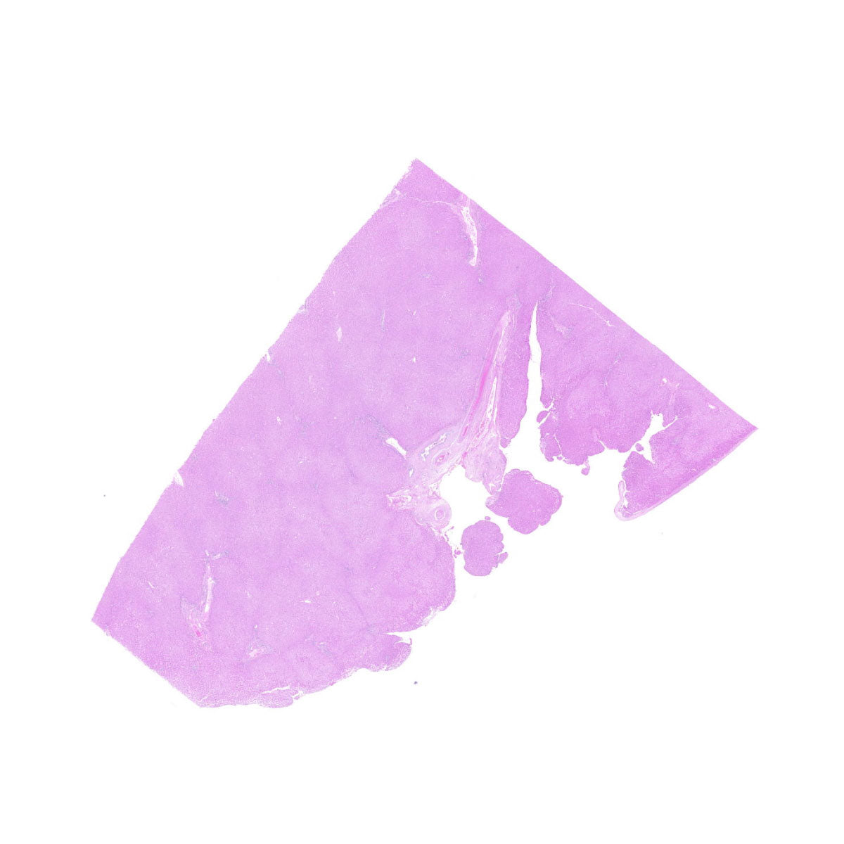 Human FFPE NAT Liver Tissue HuN-14-0087B