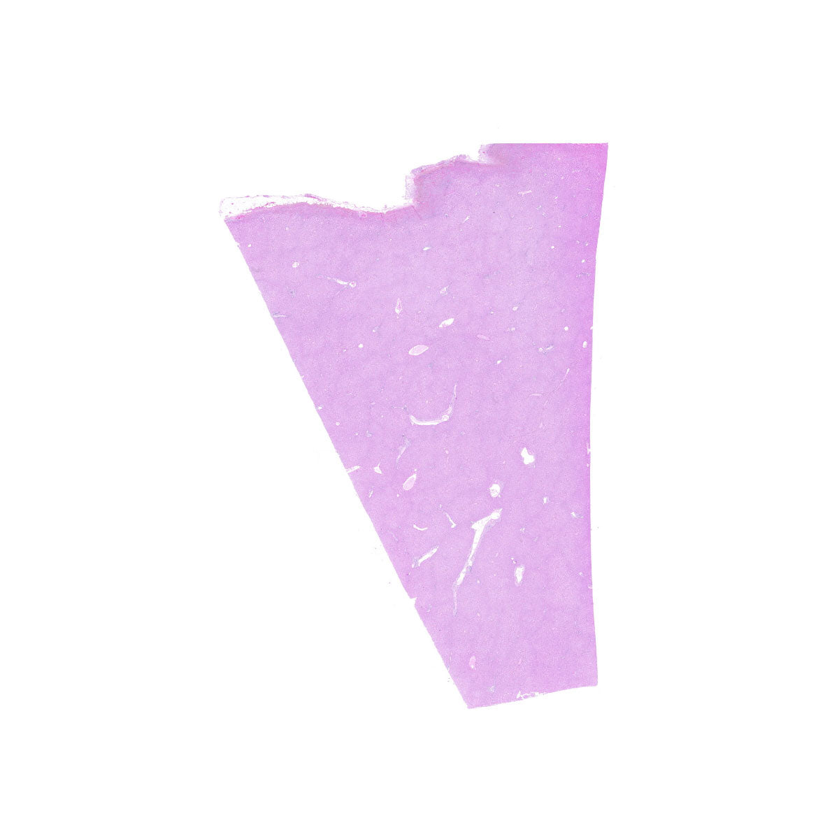 Human FFPE NAT Liver Tissue HuN-14-0088